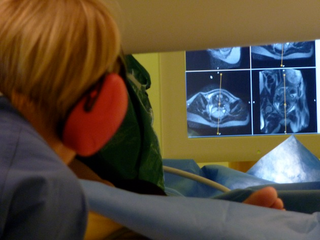 Illustration for article titled Bonus: Stills Of The MRI Live Birth